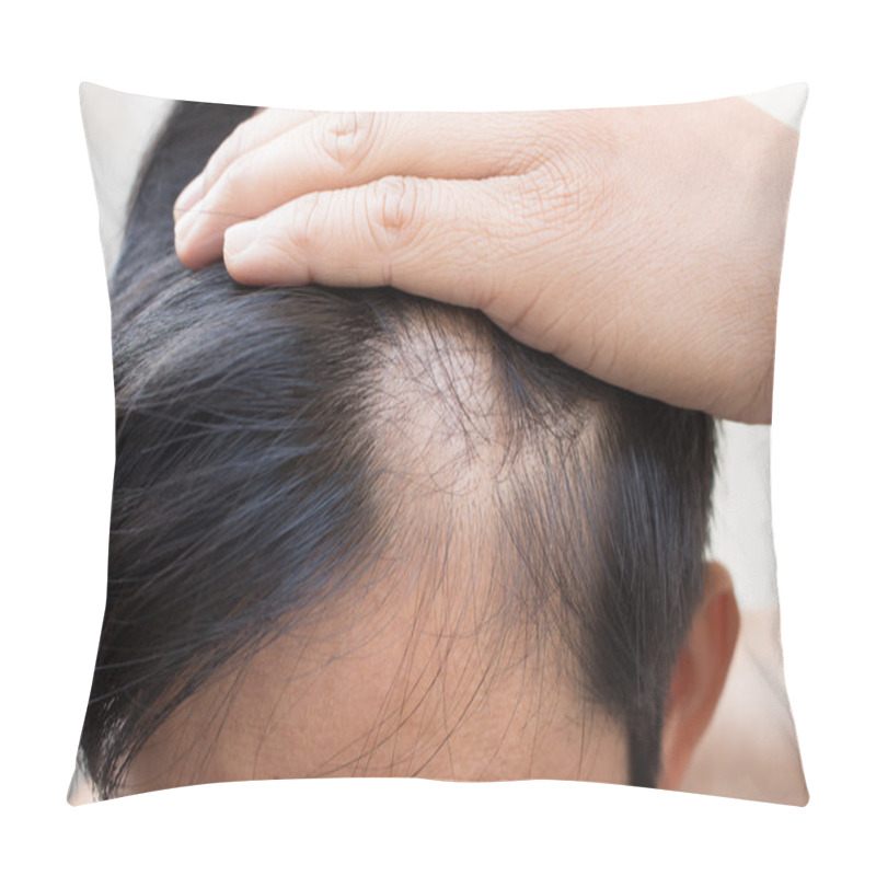 Personality  Hair Loss Pillow Covers