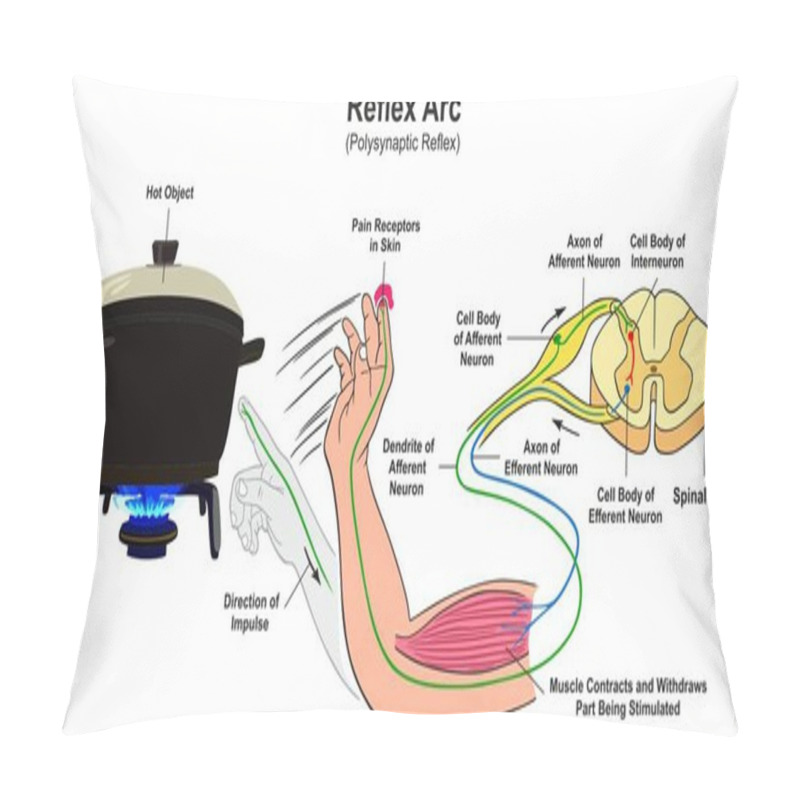 Personality  Reflex Arc Infographic Diagram With Example Of Polysynaptic Reflex Human Hand Touching Hot Object Pain Receptors And Direction Of Impulse For Medical Science Education Pillow Covers