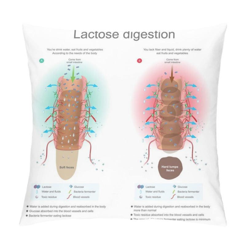 Personality  Lactose Digestion. Water Is Added During Digestion And Reabsorb In The Body. Bacteria Fermenter Eating Lactose. Toxic Residue Absorbed Into Blood Vessels And Cells. Illustration Anatomy. Pillow Covers