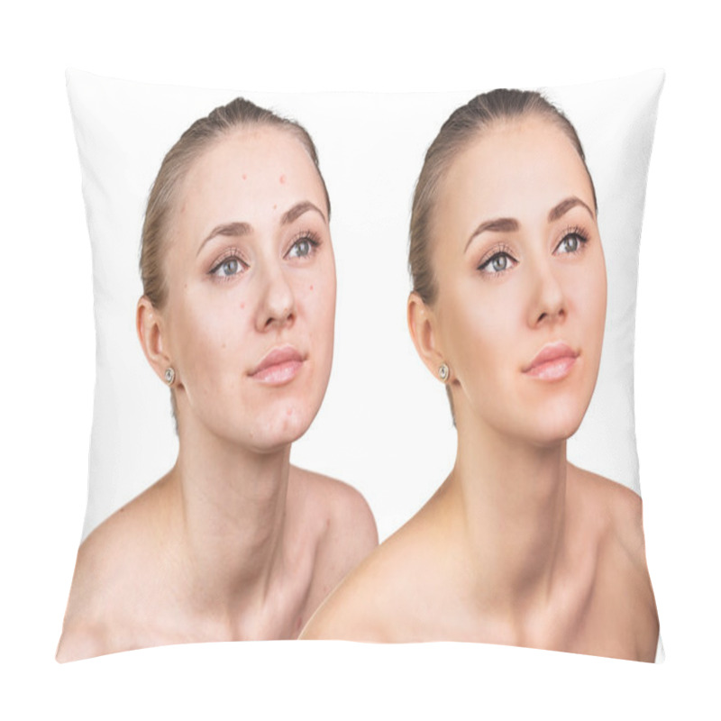 Personality  Woman With Problem Skin On Her Face Pillow Covers