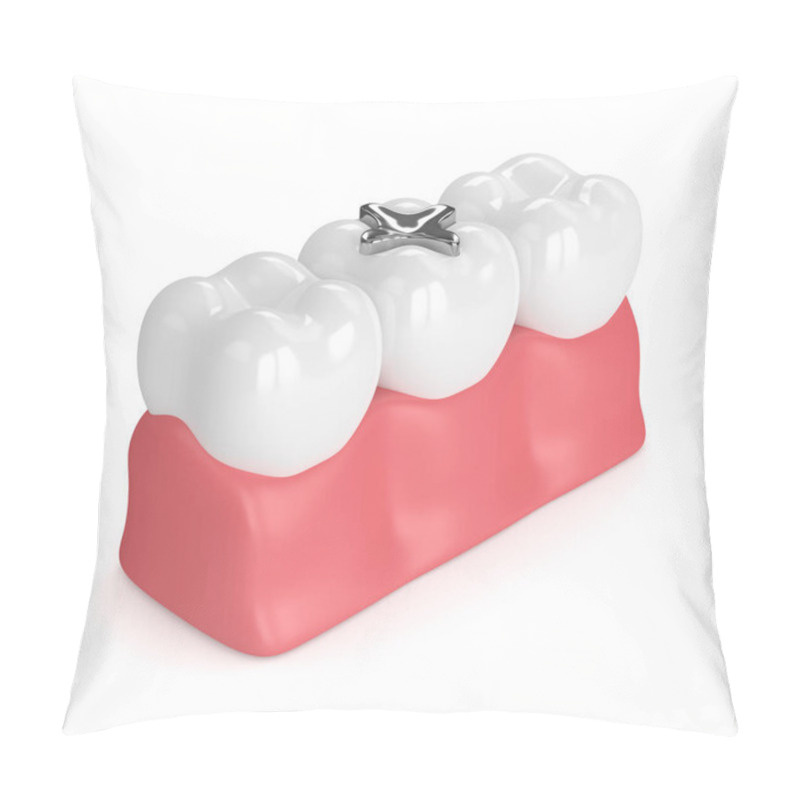 Personality  3d Render Of Teeth With Dental Amalgam Filling Pillow Covers