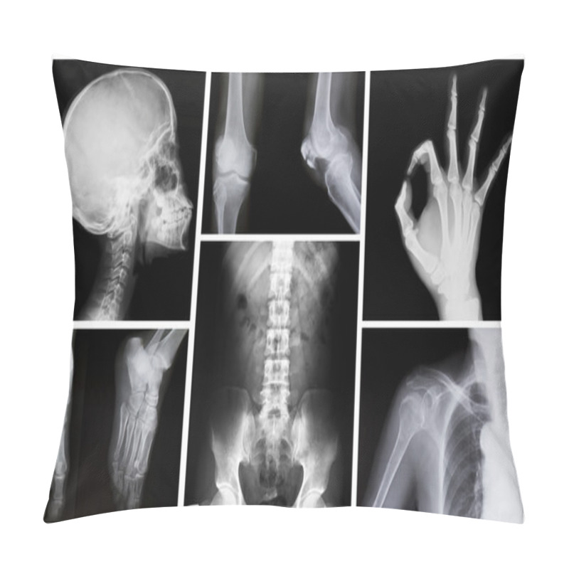 Personality  Collection Of X-ray Pillow Covers