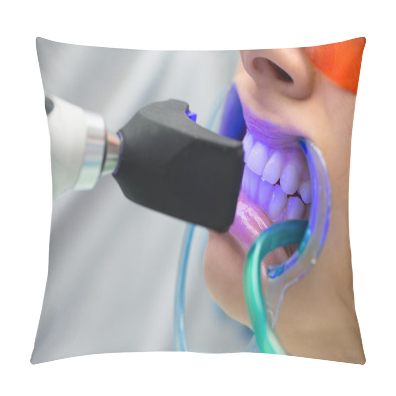 Personality  Tooth Filling Ultraviolet Lamp Pillow Covers