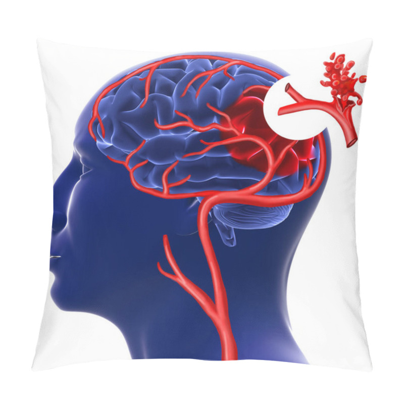 Personality  Brain Hemorrhage. 3d Rendering Pillow Covers