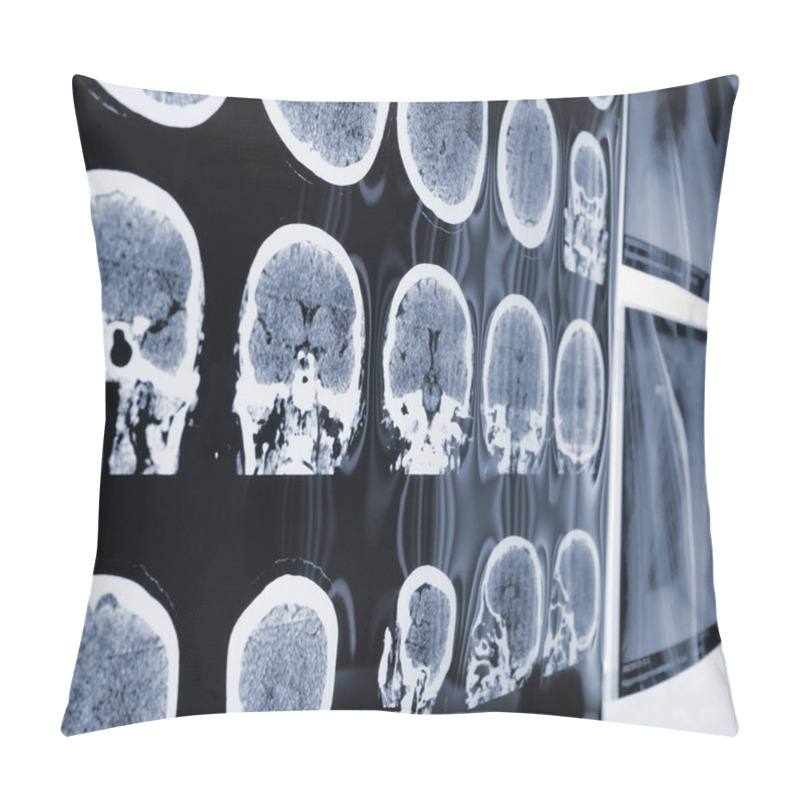 Personality  Unusual View Of The MRI, X-ray Images Of The Patient Pillow Covers