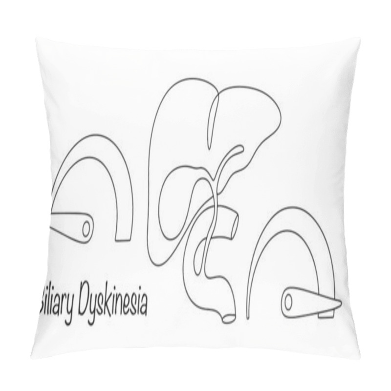 Personality  Biliary Dyskinesia. A Condition Of Increased Or Too Deteriorated Functioning Of The Biliary Tract. Single Line Diagram Of The Disease. Isolated Vector.  Pillow Covers