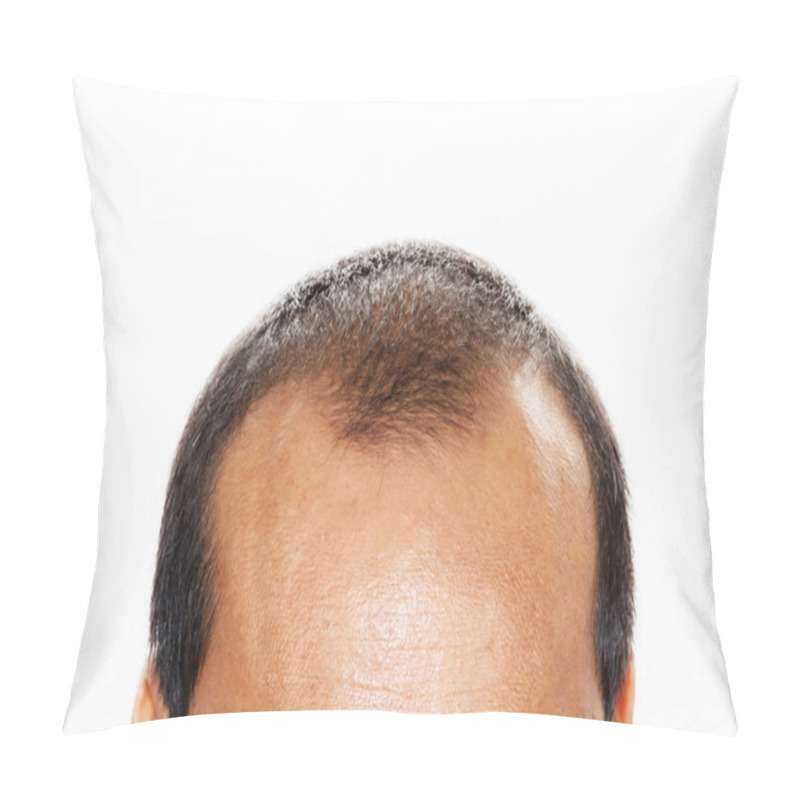 Personality  Male Head With Hair Loss Symptoms Front Side. Pillow Covers