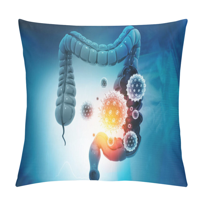 Personality  Colon Cancer, Bacterias, Viruses In Sick Unhealthy Intestine. 3d Illustration	 Pillow Covers