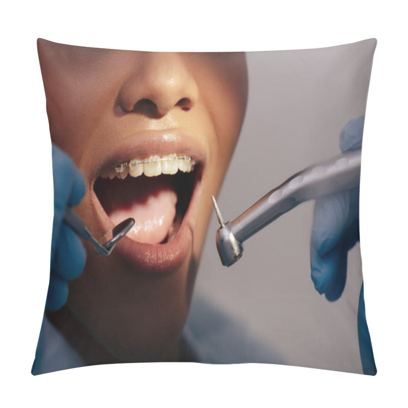 Personality  Cropped View Of Orthodontist In Latex Gloves Holding Dental Instruments Near Happy African American Woman In Braces  Pillow Covers