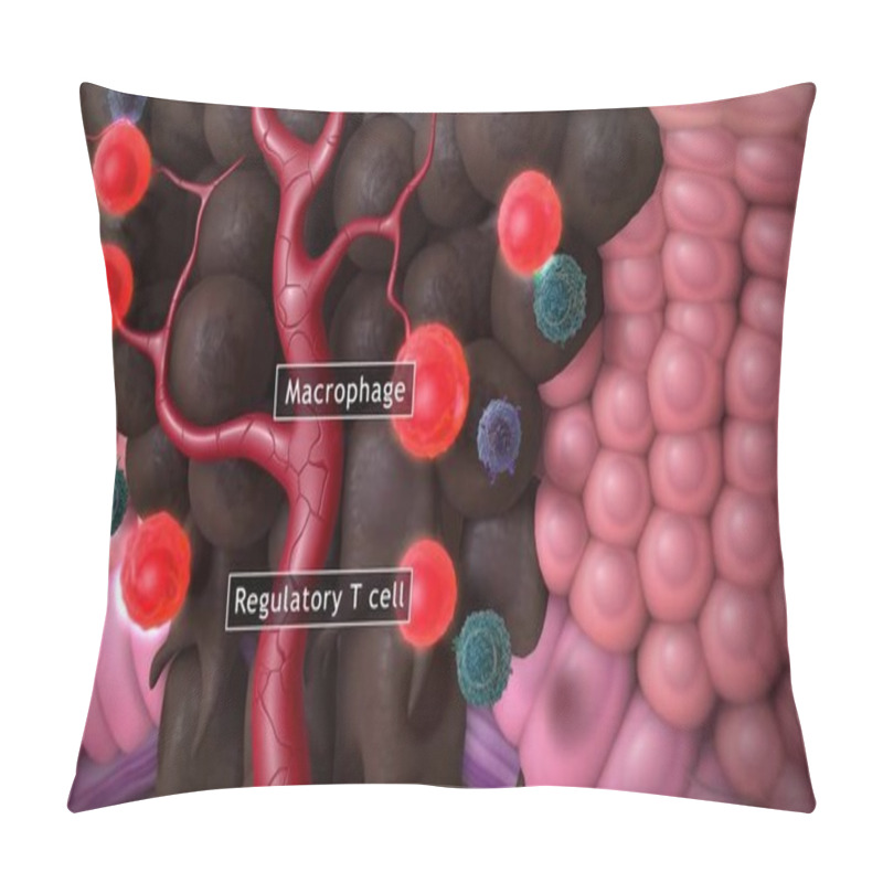 Personality  Melanoma Or Skin Cancer. Layers Of The Human Skin. Pillow Covers