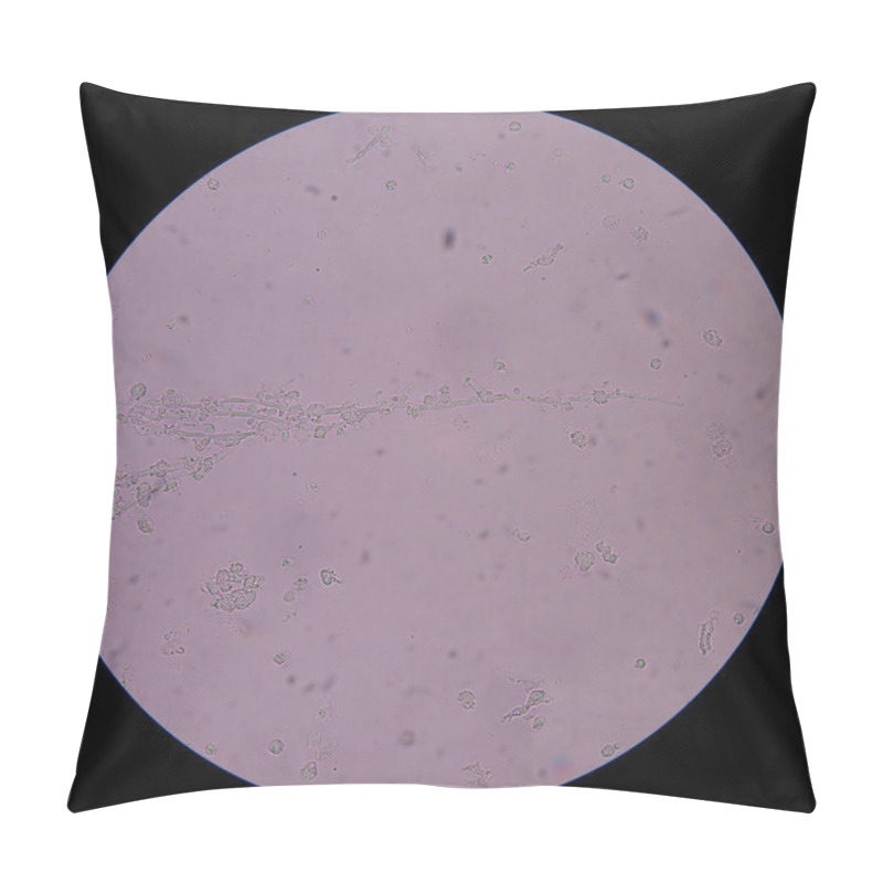 Personality  Branching Budding Yeast Cells With Pseudohyphae In Urine Pillow Covers