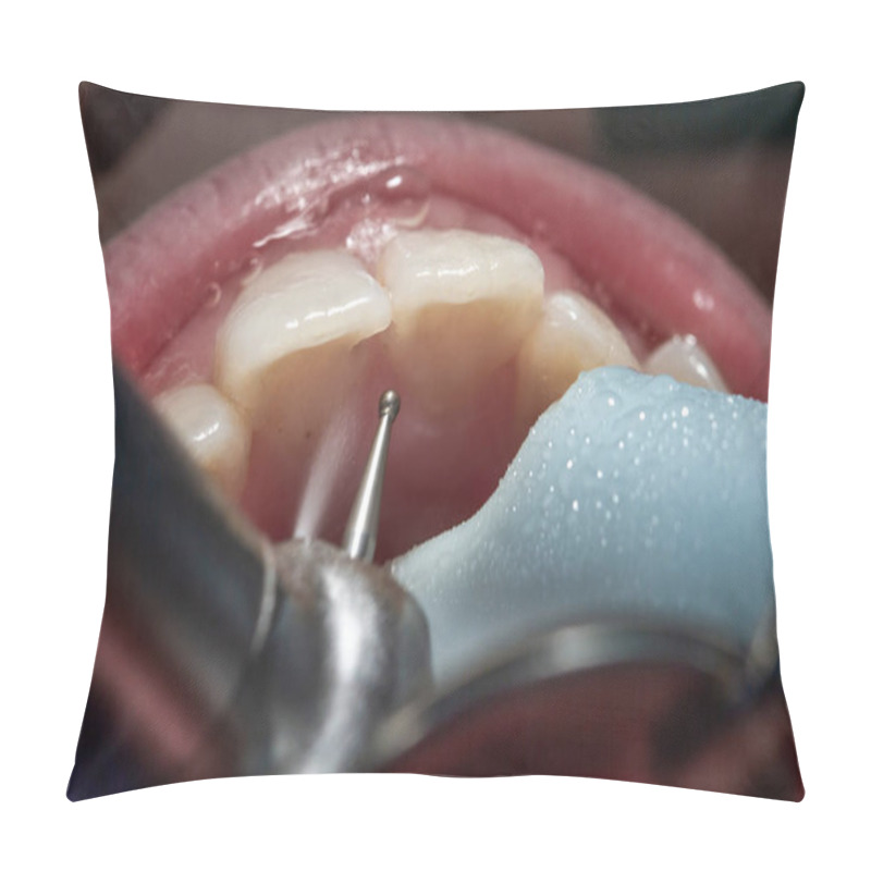 Personality  Boy At The Dentist's Appointment. Examination Of The Child's Mouth And Teeth. Pillow Covers