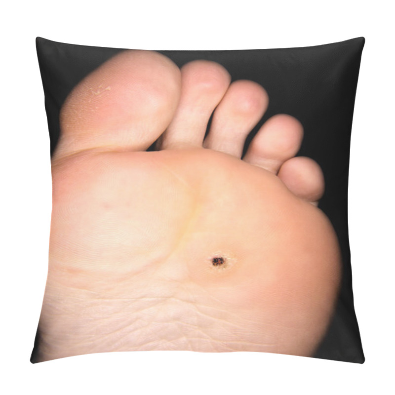 Personality  Callus Under Foot Pillow Covers