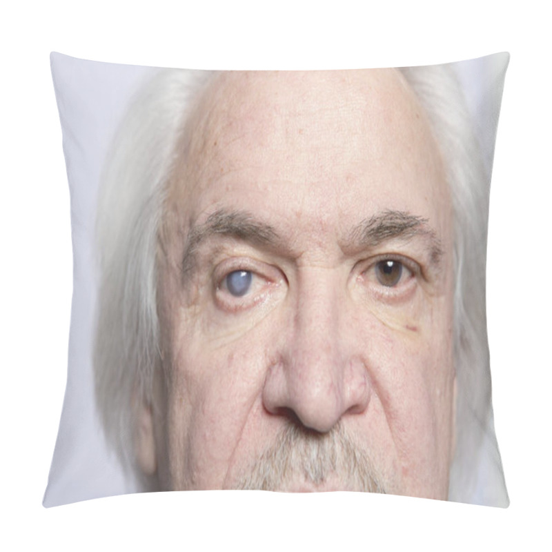 Personality  Eye Disease Treatment Pillow Covers