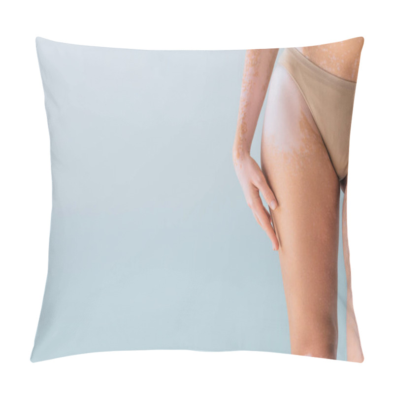 Personality  Partial View Of Young Woman With Vitiligo Standing In Panties Isolated On Grey Pillow Covers