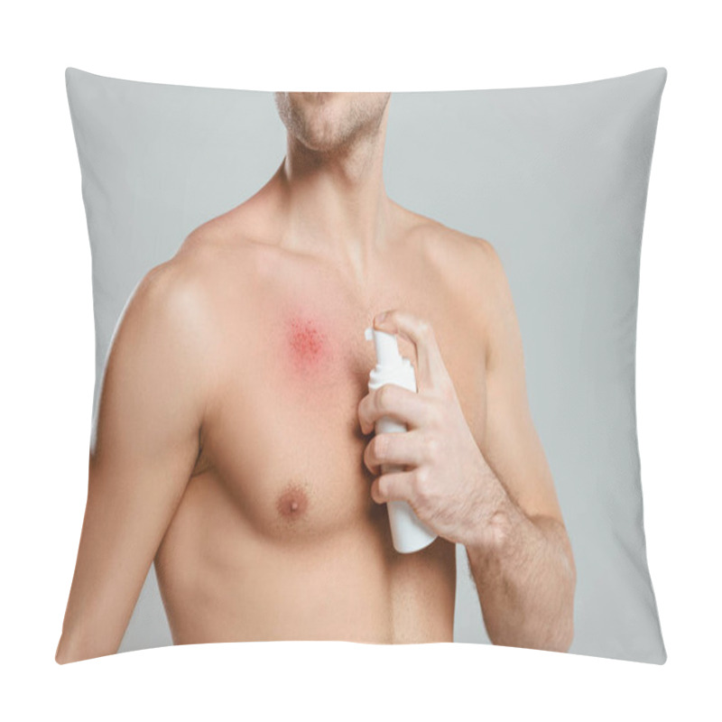 Personality  Cropped View Of Man Applying Foam On Redness On Skin Isolated On Grey Pillow Covers