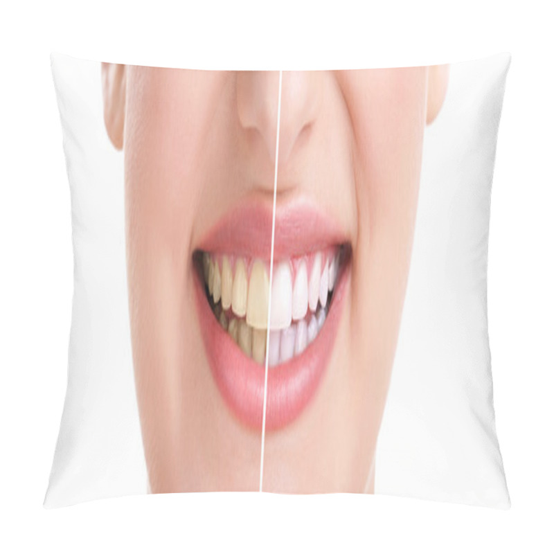 Personality  Healthy Teeth And Smile Pillow Covers