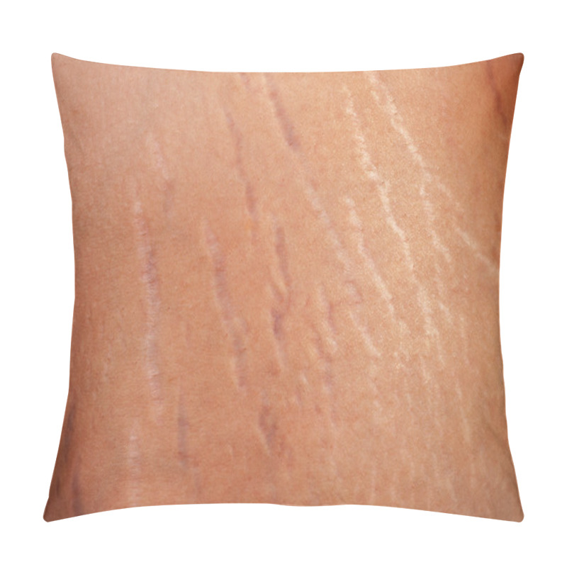 Personality  Stretch Marks On The Body Pillow Covers