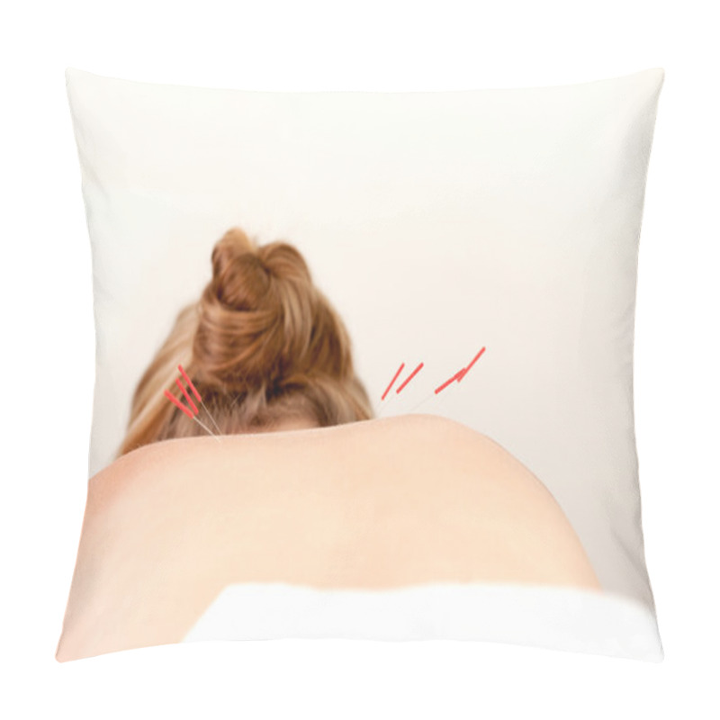 Personality  Acupuncture Needles On Back Pillow Covers