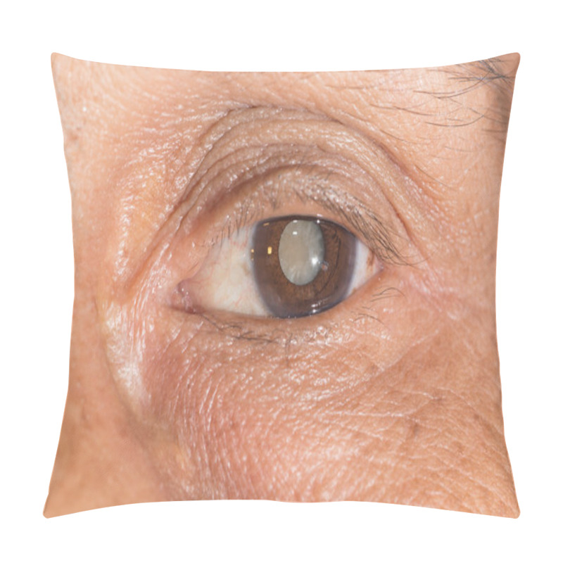 Personality  Cataract Pillow Covers