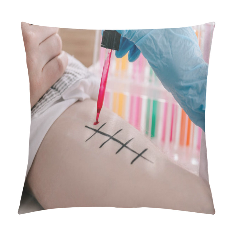 Personality  Cropped View Of Doctor In Holding Pipette With Red Liquid Near Male Hand While Making Allergy Test In Laboratory  Pillow Covers