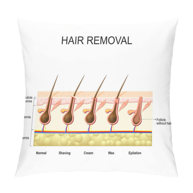 Personality  Hair Removal With Wax, Cream, Epilation And Shaving.  Pillow Covers