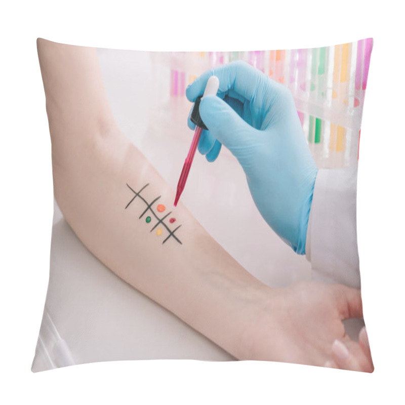 Personality  Cropped View Of Doctor In Latex Glove Holding Pipette With Liquid While Making Allergy Test Pillow Covers