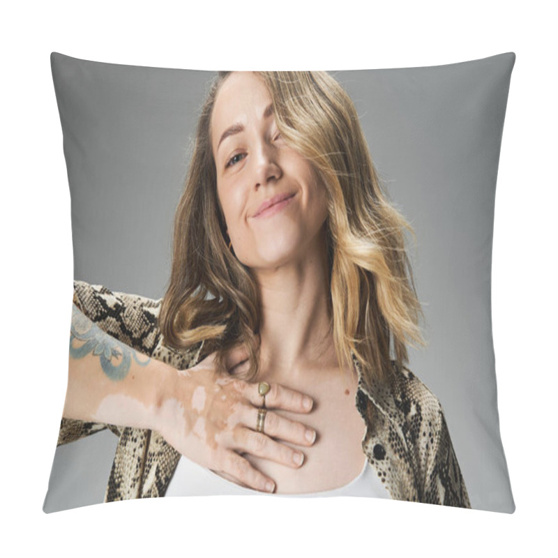 Personality  Confident Young Woman With Vitiligo Smiles, Showcasing Her Unique Style And Features. Pillow Covers