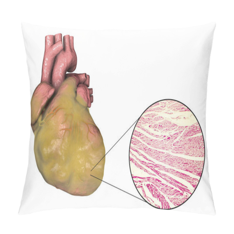 Personality  Obese Heart, Illustration Pillow Covers