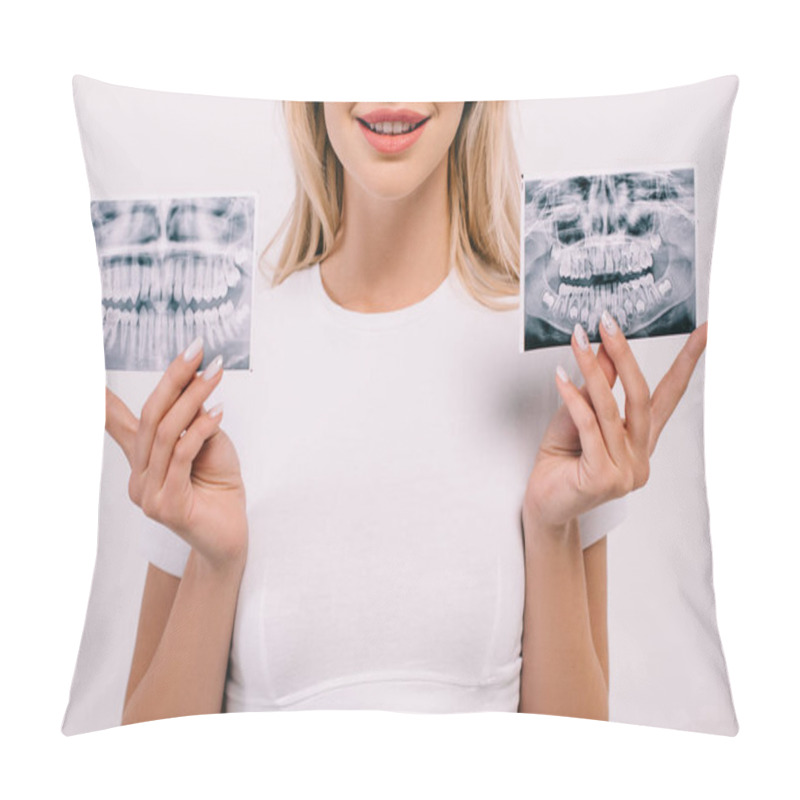 Personality  Cropped View Of Smiling Woman In T-shirt Holding Teeth X-rays Isolated On White Pillow Covers