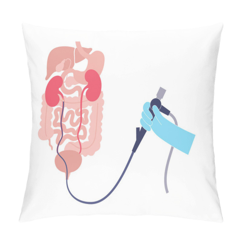 Personality  Ureteroscopy Is A Minimally Invasive Procedure. Examination And Treatment Of The Kidney. Disorder Of The Urinary System, Cancer, Polyps, Stones Or Inflammation. Poster Of Urinary Tract Medical Vector Pillow Covers