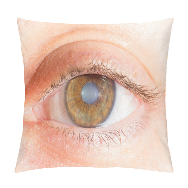 Personality  Oculistic Exam Of Eye With Cataracts Pillow Covers