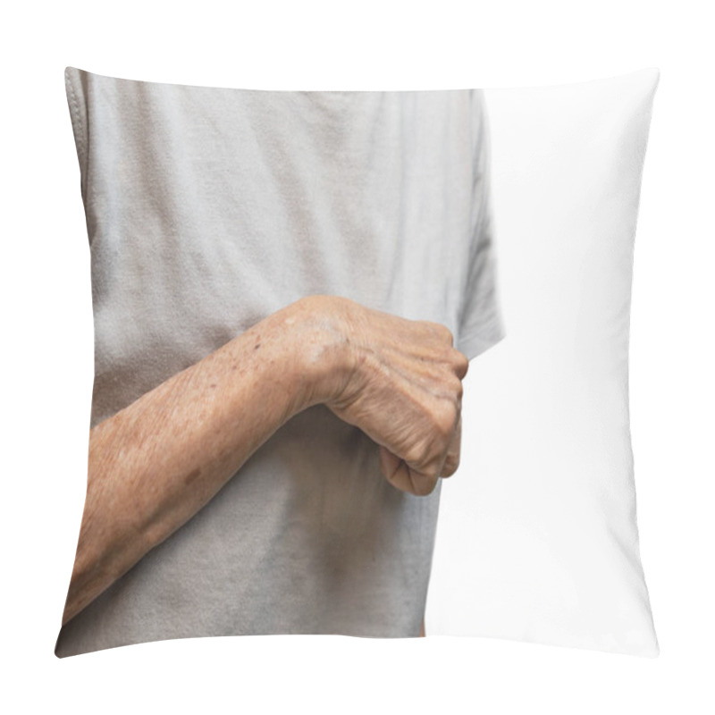 Personality  Volkmann Contracture In Left Upper Limb Of Southeast Asian Old  Woman. It Is A Permanent Shortening Of Forearm Muscles That Gives Rise To A Clawlike Posture Of The Hand, Fingers, And Wrist. Pillow Covers