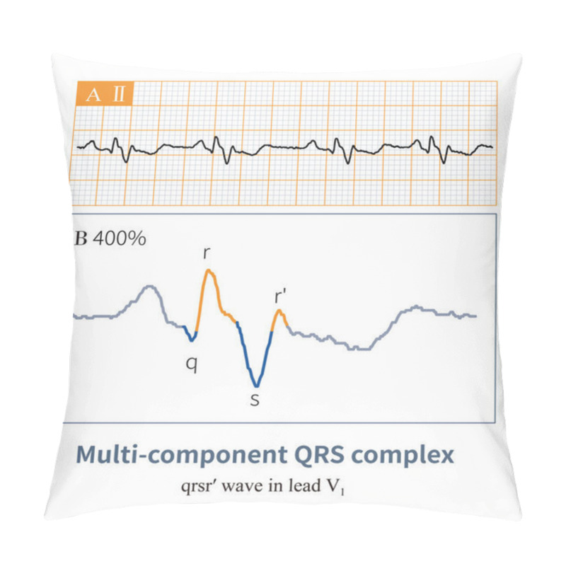 Personality  When There Are More Than 3 Components In The QRS Wave Of Lead V1, Do Not Diagnose It As Right Bundle Branch Block, As This Is A Manifestation Of Fragmented QRS Wave. Pillow Covers