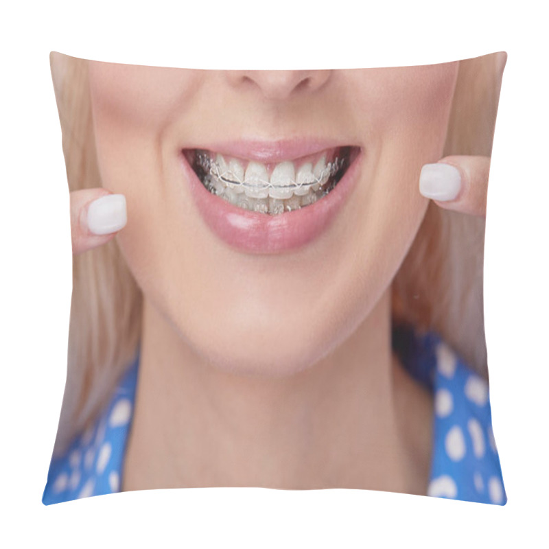 Personality  Beautiful Macro Shot Of White Teeth With Braces. Dental Care Photo. Beauty Woman Smile With Ortodontic Accessories. Orthodontics Treatment. Closeup Of Healthy Female Mouth Pillow Covers