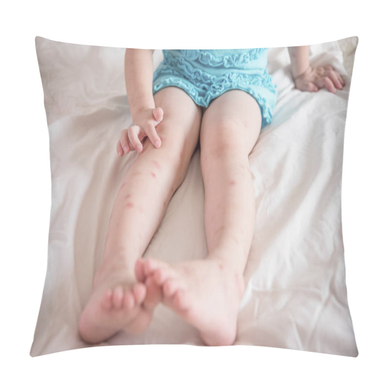 Personality  Mosquito Bites Sore On Legs Pillow Covers