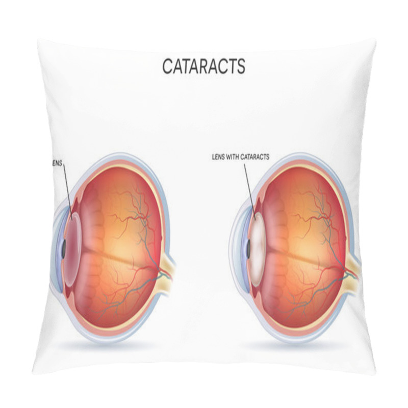 Personality  Cataracts Pillow Covers