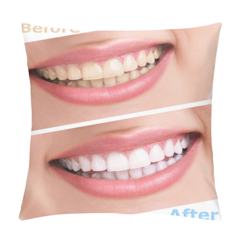 Personality  Bleaching Teeth Treatment Pillow Covers