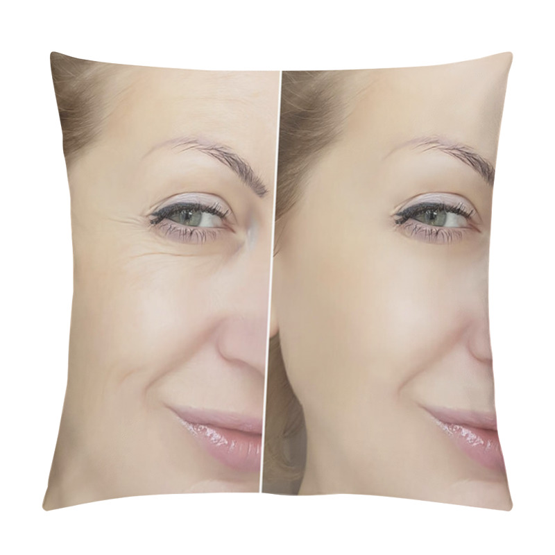 Personality  Woman Face Wrinkles Before And After Pillow Covers