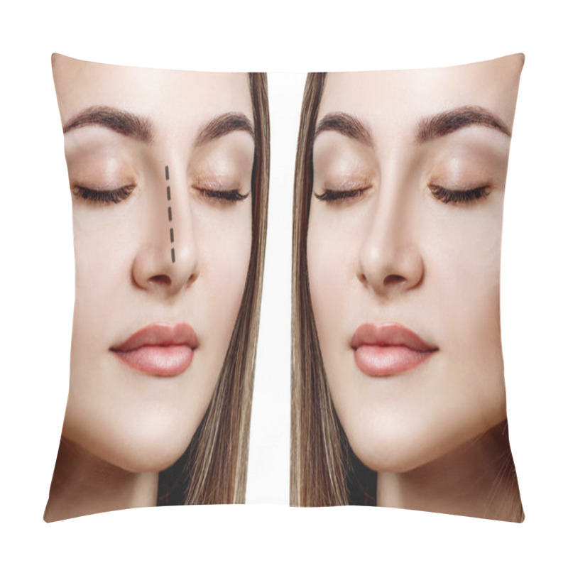 Personality  Female Nose Before And After Cosmetic Surgery. Pillow Covers