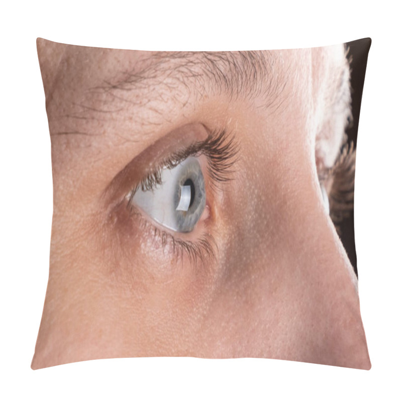 Personality  Woman Eye With Corneal Dystrophy, Keratoconus, Thinning Of The Cornea Pillow Covers