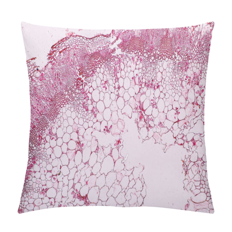 Personality  Zygomycota, Or Zygote Fungi ,Downy Mildew Of Cruzifers Host Tissue With Conidia Living In Decaying Plant On Slide Under The Microscope For Education. Pillow Covers