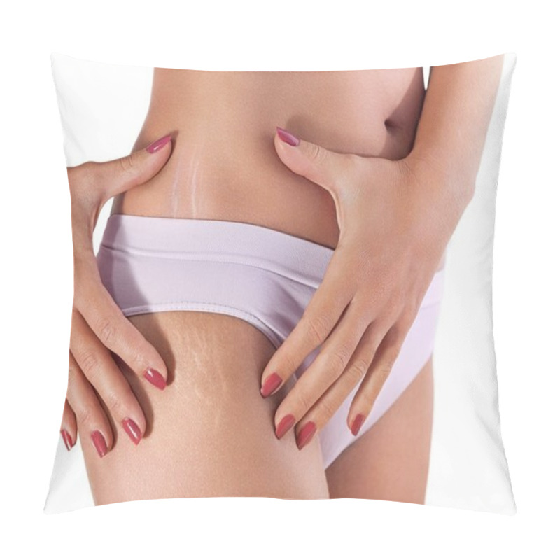 Personality   Stretch Marks On Female Hips Pillow Covers