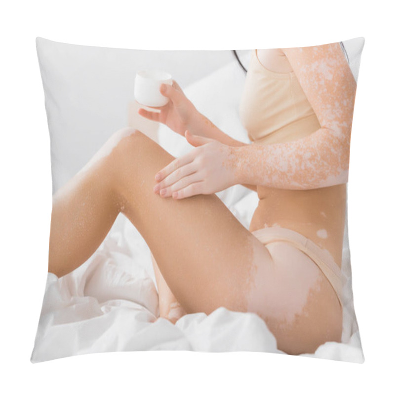 Personality  Partial View Of Young Woman With Vitiligo Holding Container With Cosmetic Cream In Bedroom  Pillow Covers