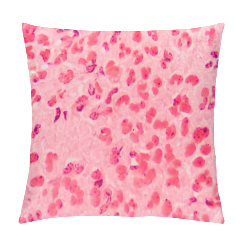 Personality  Gram Negative Diplococci Intracellular Pillow Covers