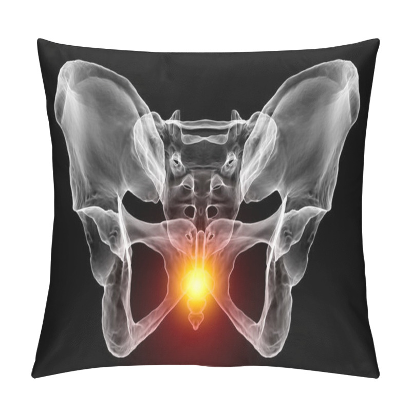 Personality  A 3D Medical Illustration Highlighting The Coccyx Bone Marked In Red, Depicting Coccyx Pain Which Can Occur Due To Injury, Childbirth, Or Prolonged Sitting. Front View Pillow Covers