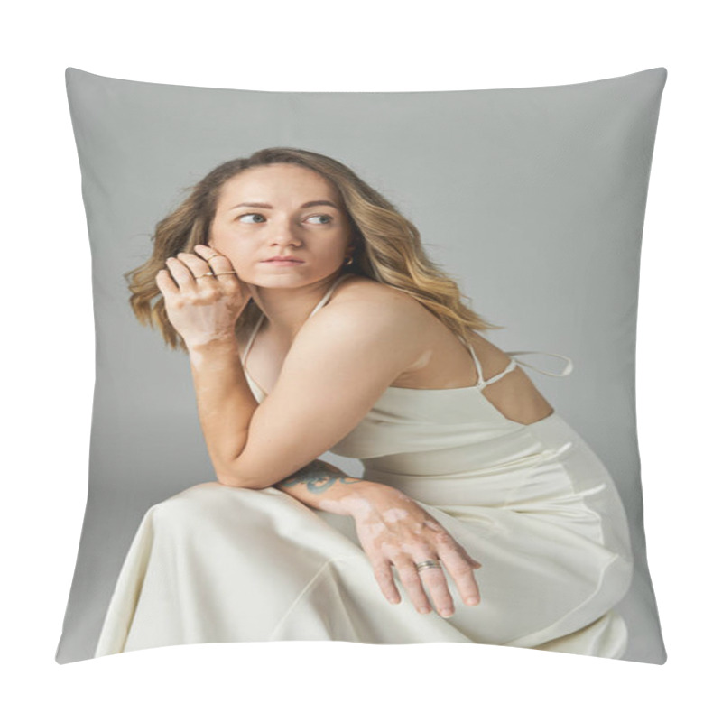 Personality  A Young Woman With Vitiligo Sits Gracefully, Highlighting Her Unique Beauty And Confident Style. Pillow Covers