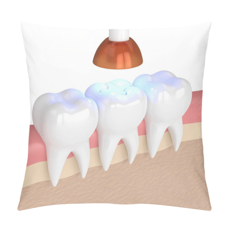 Personality  3d Render Of Teeth With Dental Polymerization Lamp And Light Cur Pillow Covers