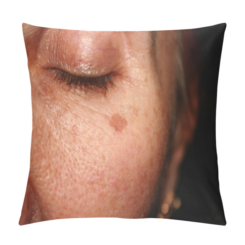 Personality  Brown Spots Under The Eye. Pigmentation On The Face Pillow Covers