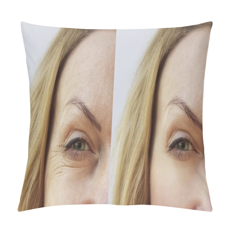 Personality  Face Wrinkles Woman Before And After Pillow Covers